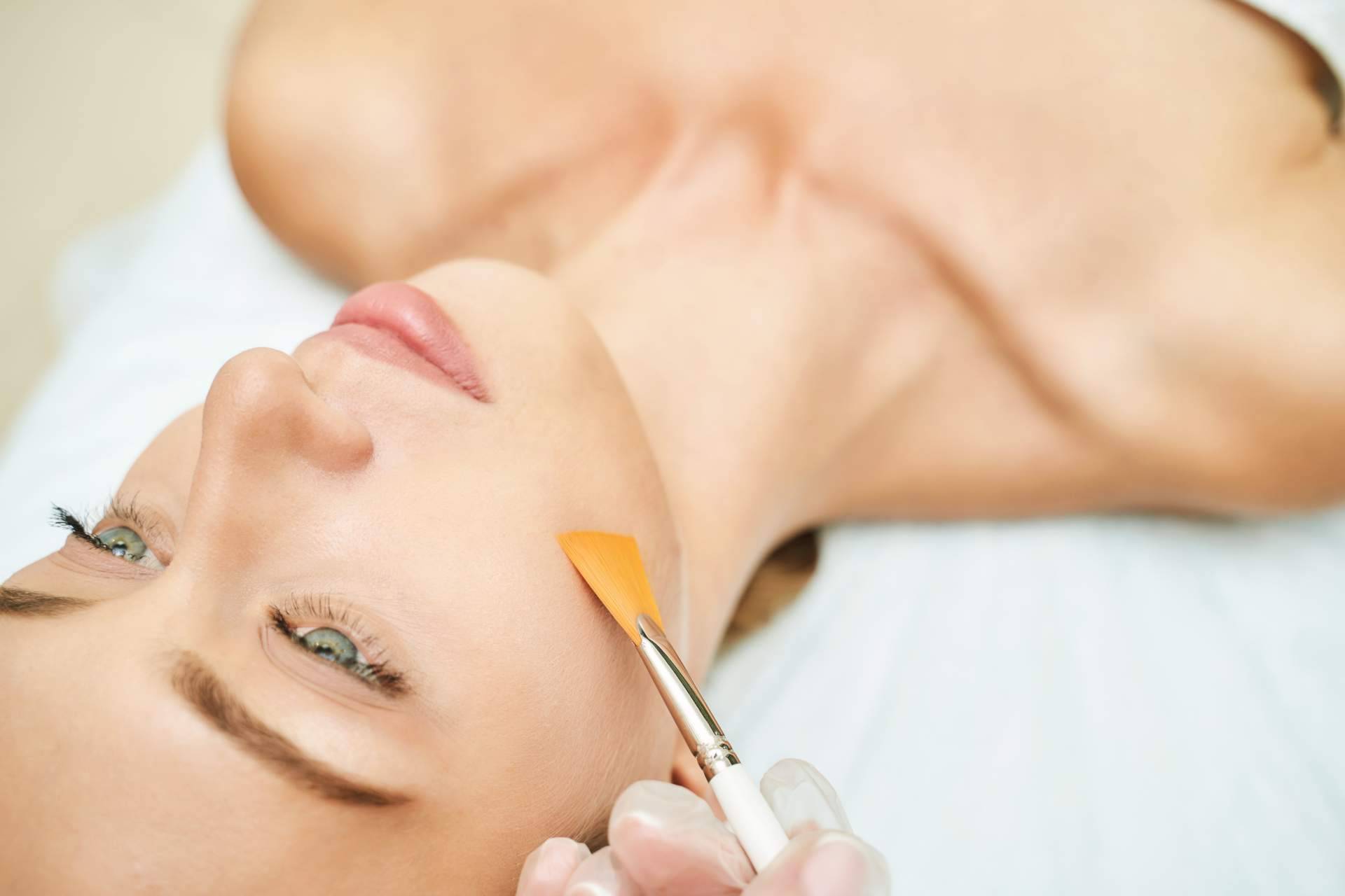 Peeling médico, el tratamiento de Unidad Femme que mejora la salud y el aspecto de la piel