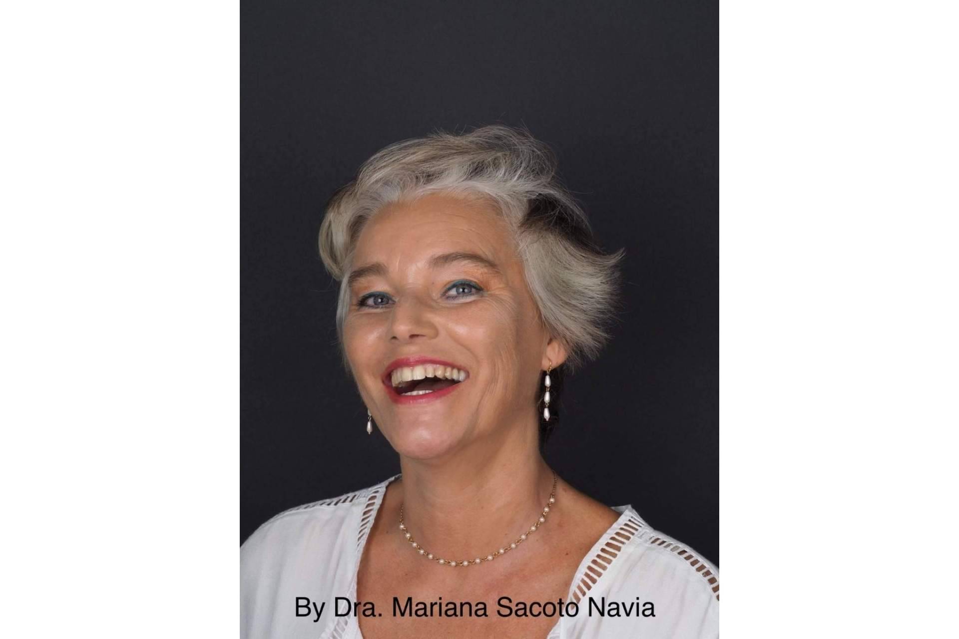 Ortodoncia para diseñar sonrisas Invisalign®