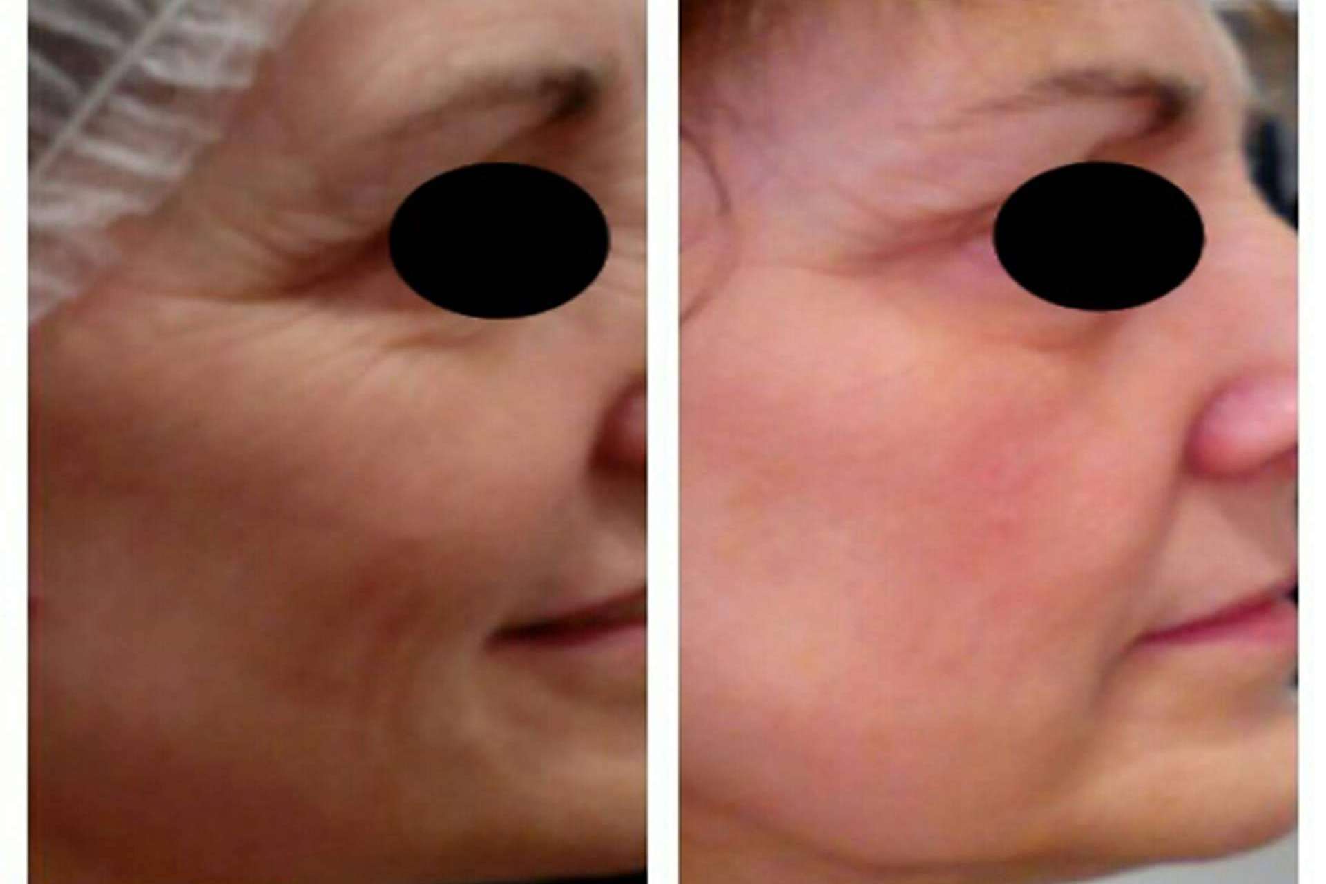 Conseguir una piel de porcelana con tratamiento facial antimanchas y otros tratamientos faciales icónicos de la compañía MiCleo&Co