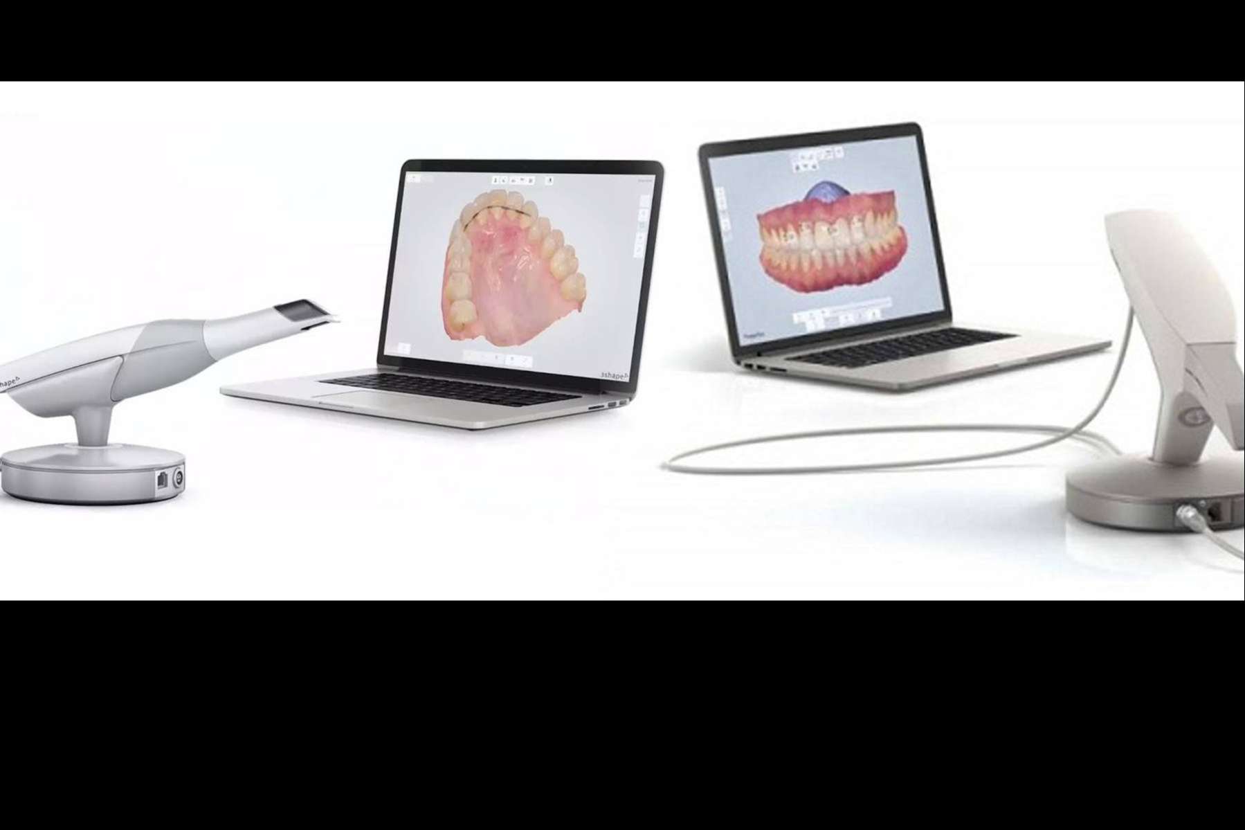 Las ventajas de la clínica dental Implant Clinics en la toma de registros con 3Shape TRIOS, un escáner de última tecnología