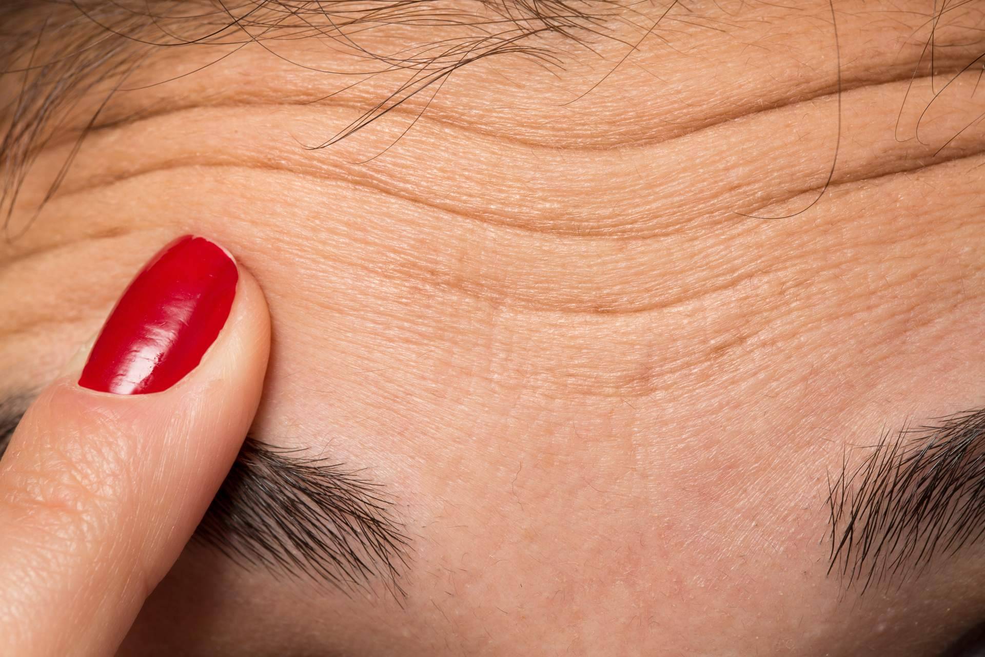 ¿Dónde llevar a cabo diseño de cejas con bótox? Clínica de Medicina Estética Sánchez Peral en Castellón