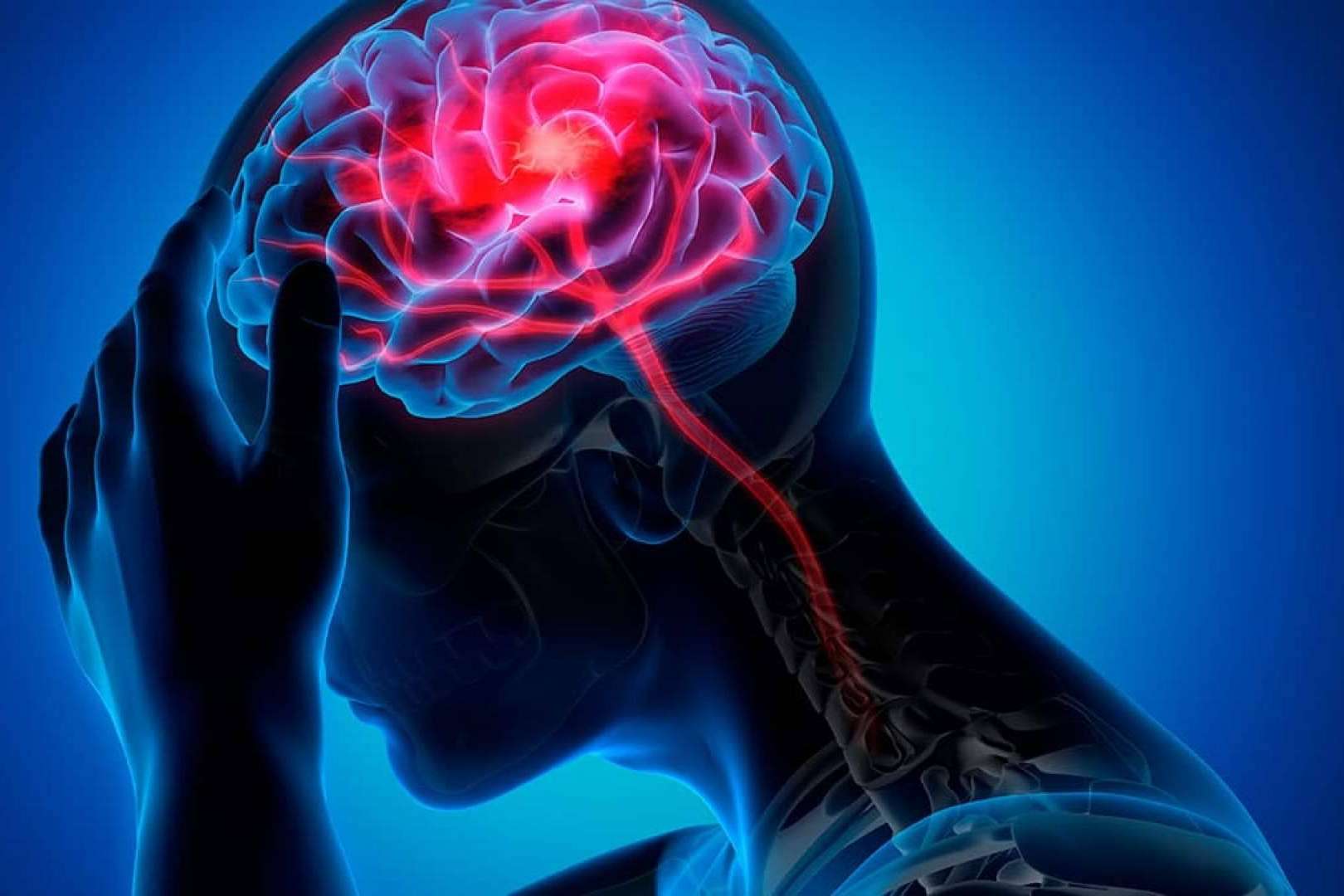 ¿Es posible recurrir a la osteopatía como tratamiento de la migraña?, por el Instituto Internacional de Osteopatía Avanzada