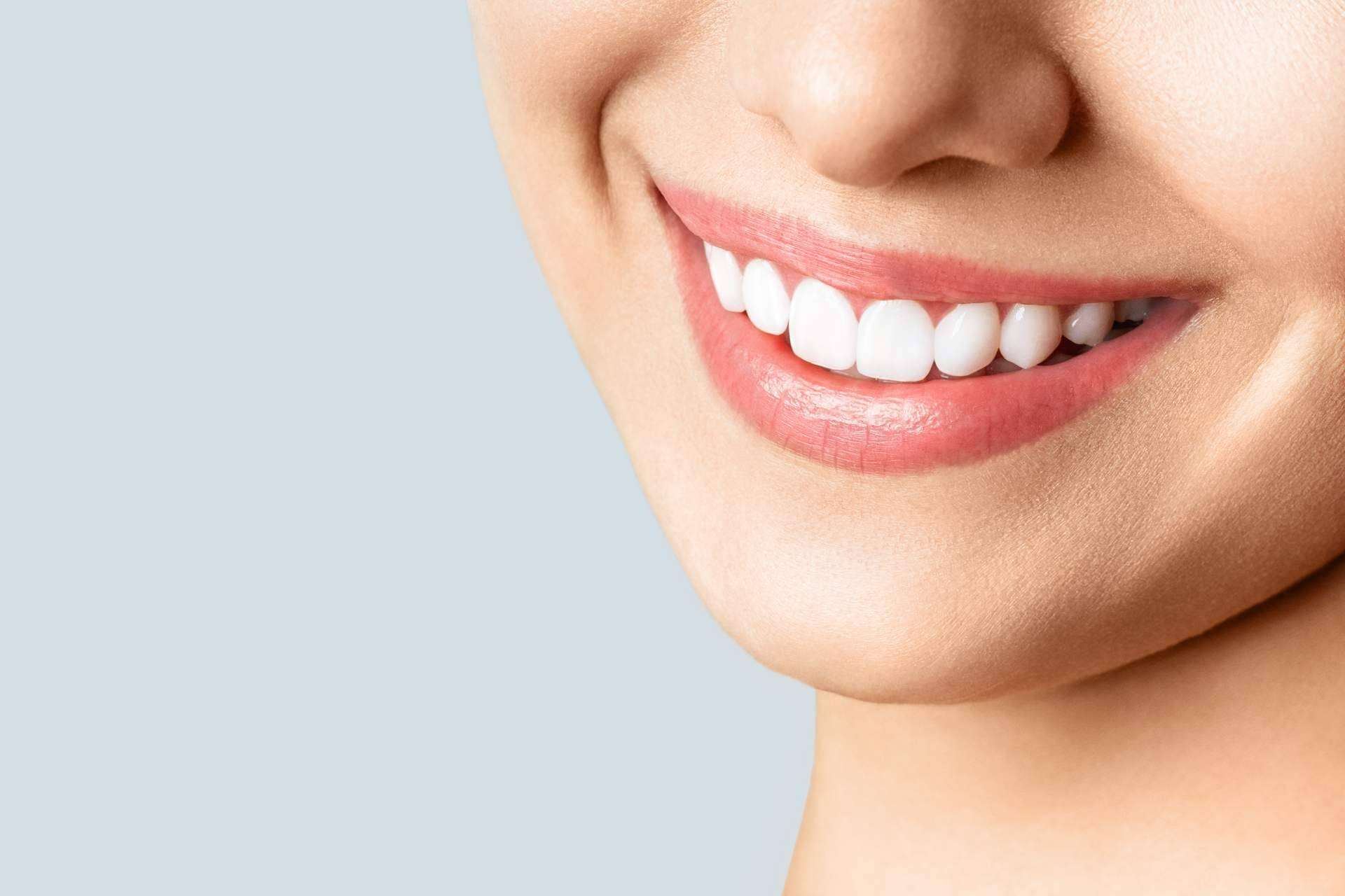 Estética dental en Collblanc para recuperar la sonrisa, de la mano de Qualident