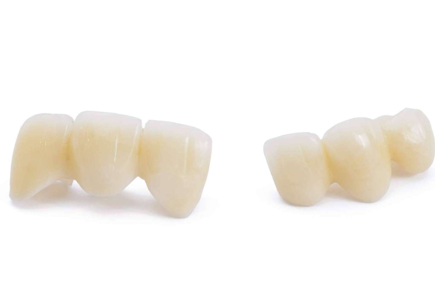 Coronas dentarias impresas con tecnología 3D en una hora, con Dentinova