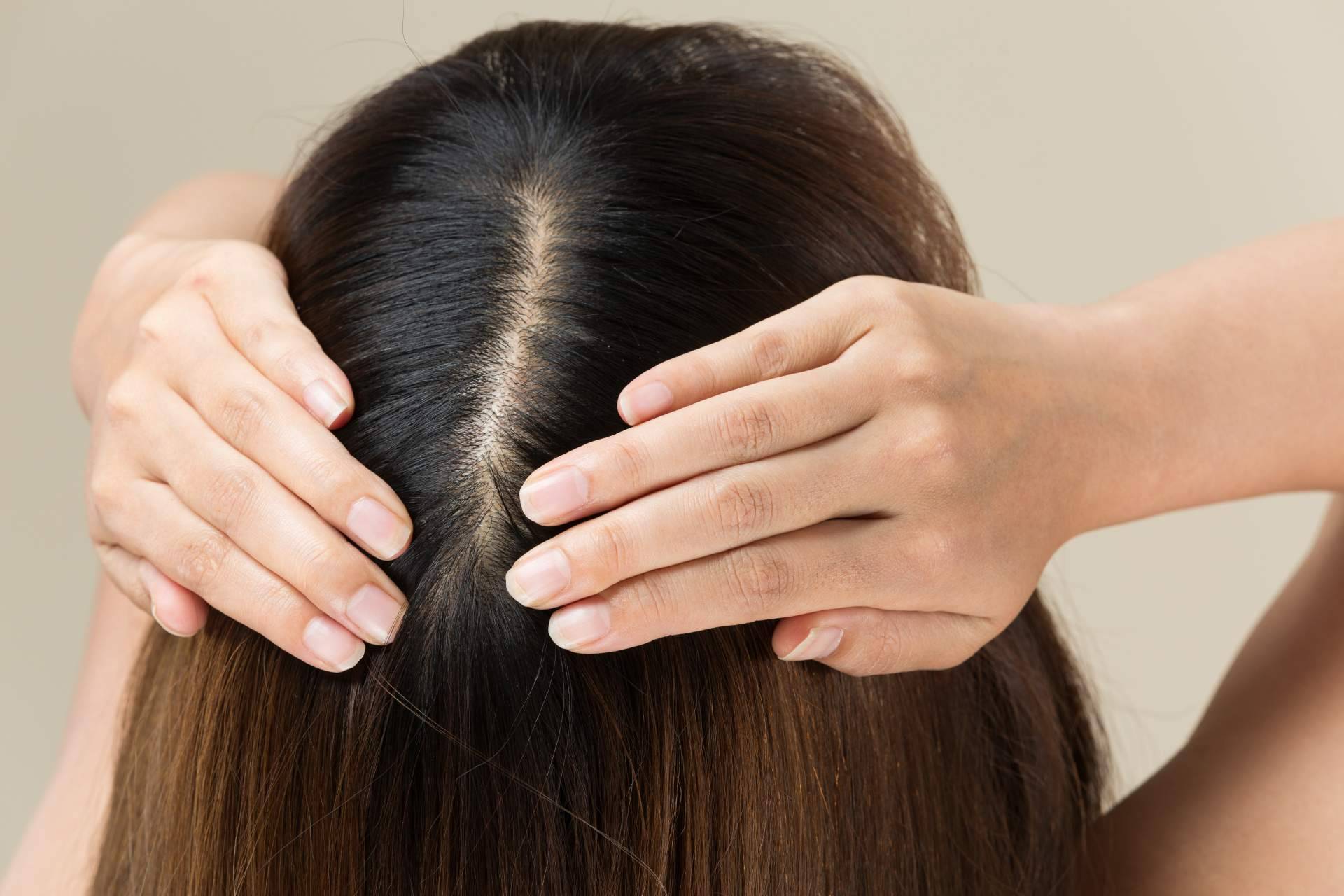 La solución MHS-Mesohair de la firma DSD de Luxe evita la caída del cabello y fortalece los folículos