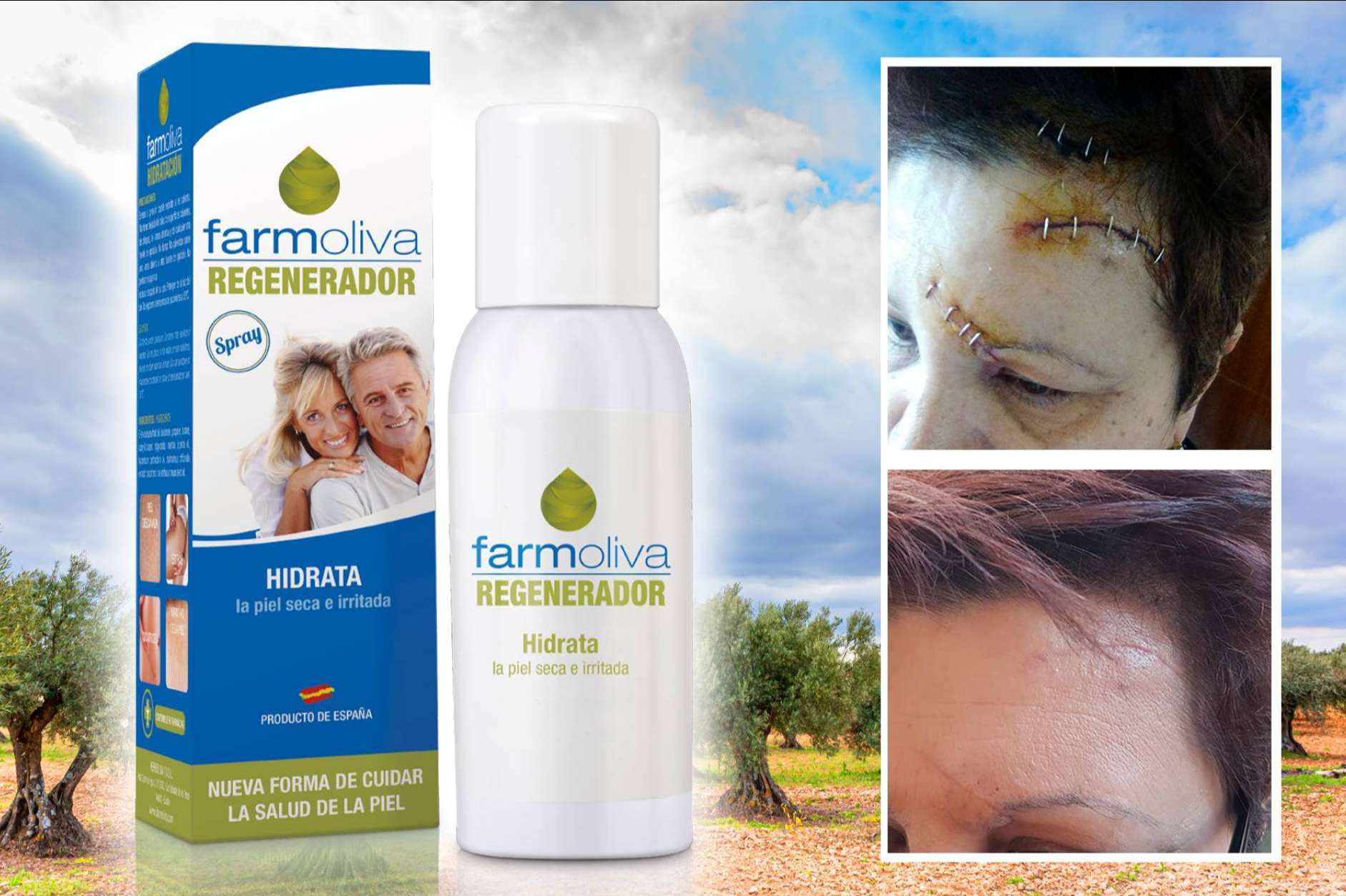El spray de Farmoliva que ayuda a la piel a regenerarse de manera natural para mantenerla sana, Farmoliva Regenerador