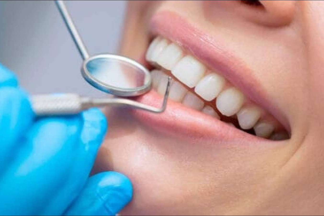 El seguro Adeslas Dental garantiza una buena salud bucal a un precio asequible