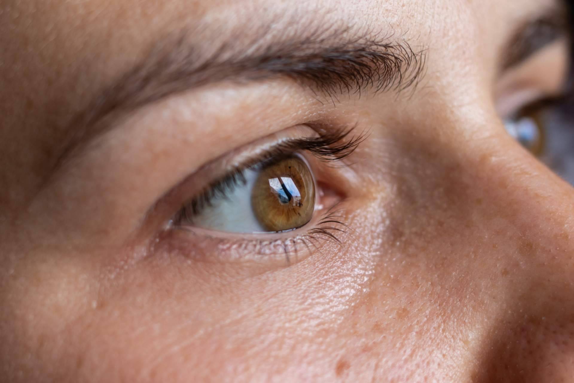 Élite Capilar emplea el método Zafiro para trasplantes de cejas