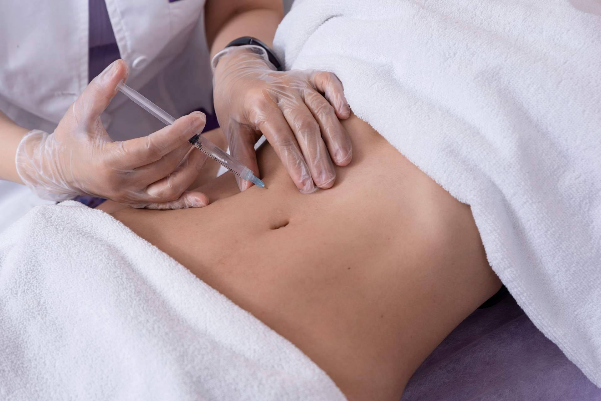 Alluring Clinic expone los beneficios de realizarse la mesoterapia corporal