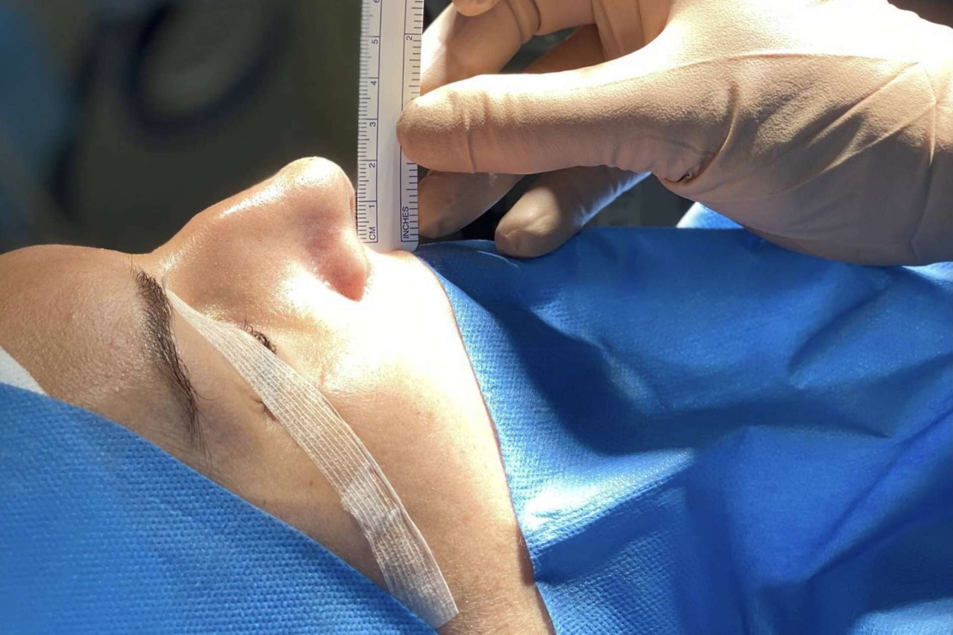 El Dr. Roy Camacho es uno de los cirujanos estéticos mejor valorados en Madrid