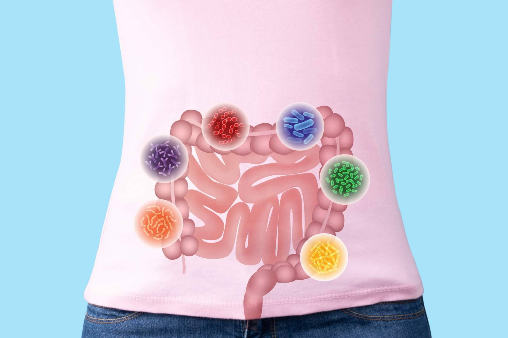 Tratamiento de disbiosis modulación terapéutica y rehabilitación intestinal, el tratamiento preferido de los jeques árabes por el Dr. Fernando Ruger Viarengo