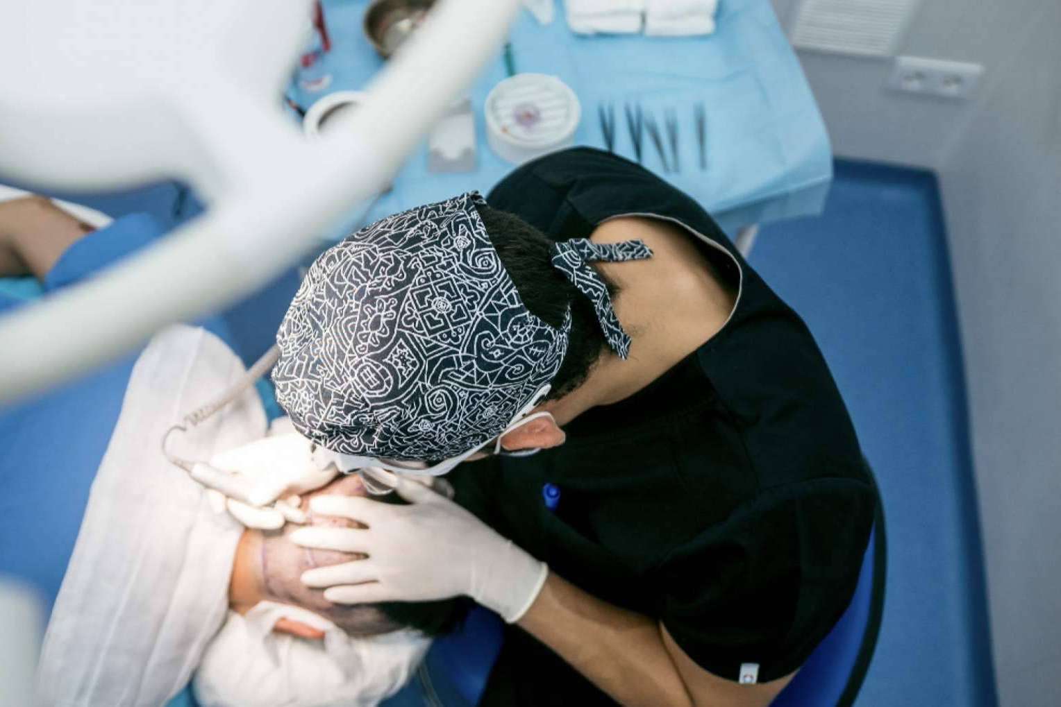 Implantes de cabello con la última tecnología, por el Dr. Bern