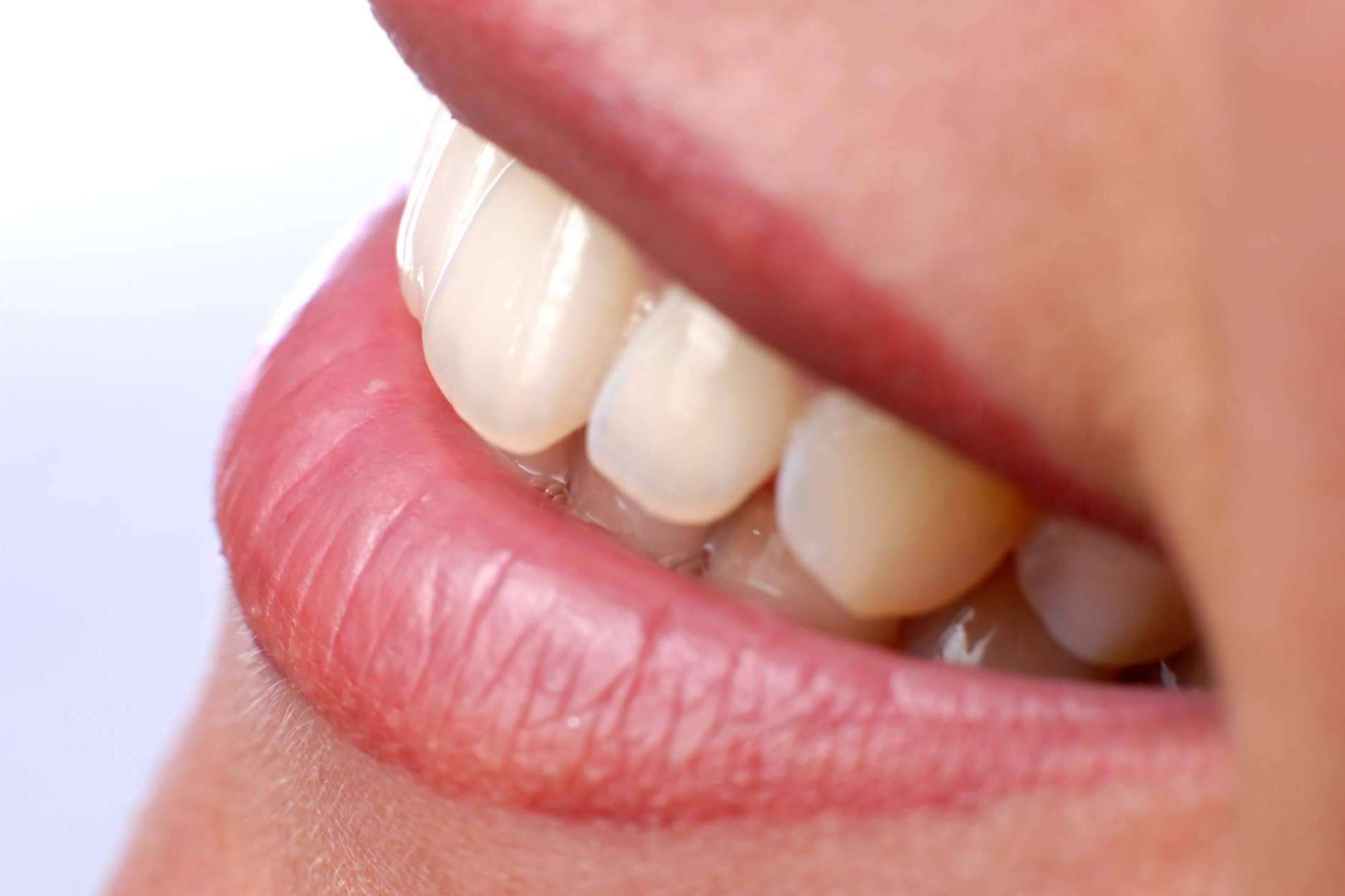 Calident permite disfrutar de una sonrisa sana y bonita gracias a sus implantes dentales