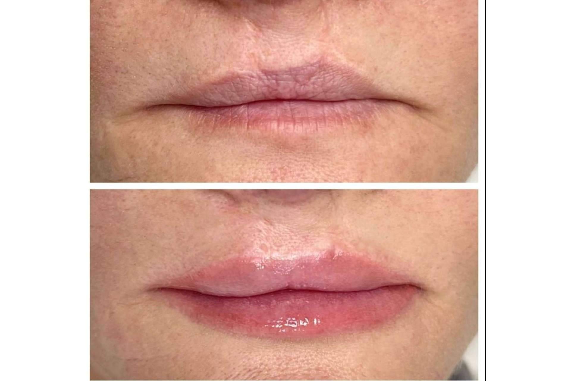 RL Clinic tiene una gran trayectoria en la industria de la medicina estética