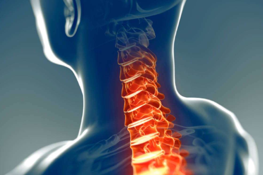 El tratamiento para las hernias discales cervicales que realiza el equipo de Biziondo