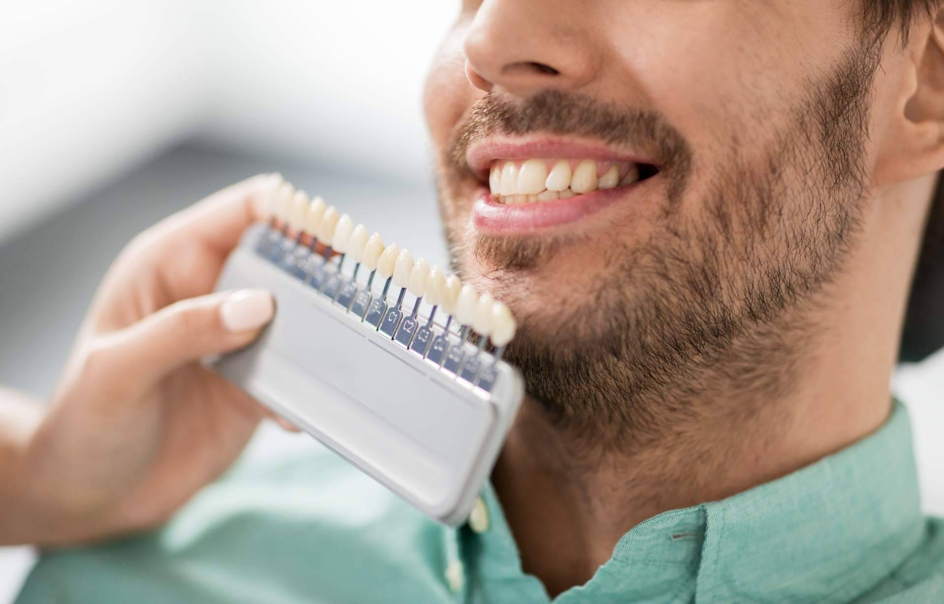 Mejorar la sonrisa de los pacientes con carillas dentales, Clínica Dental Delgado