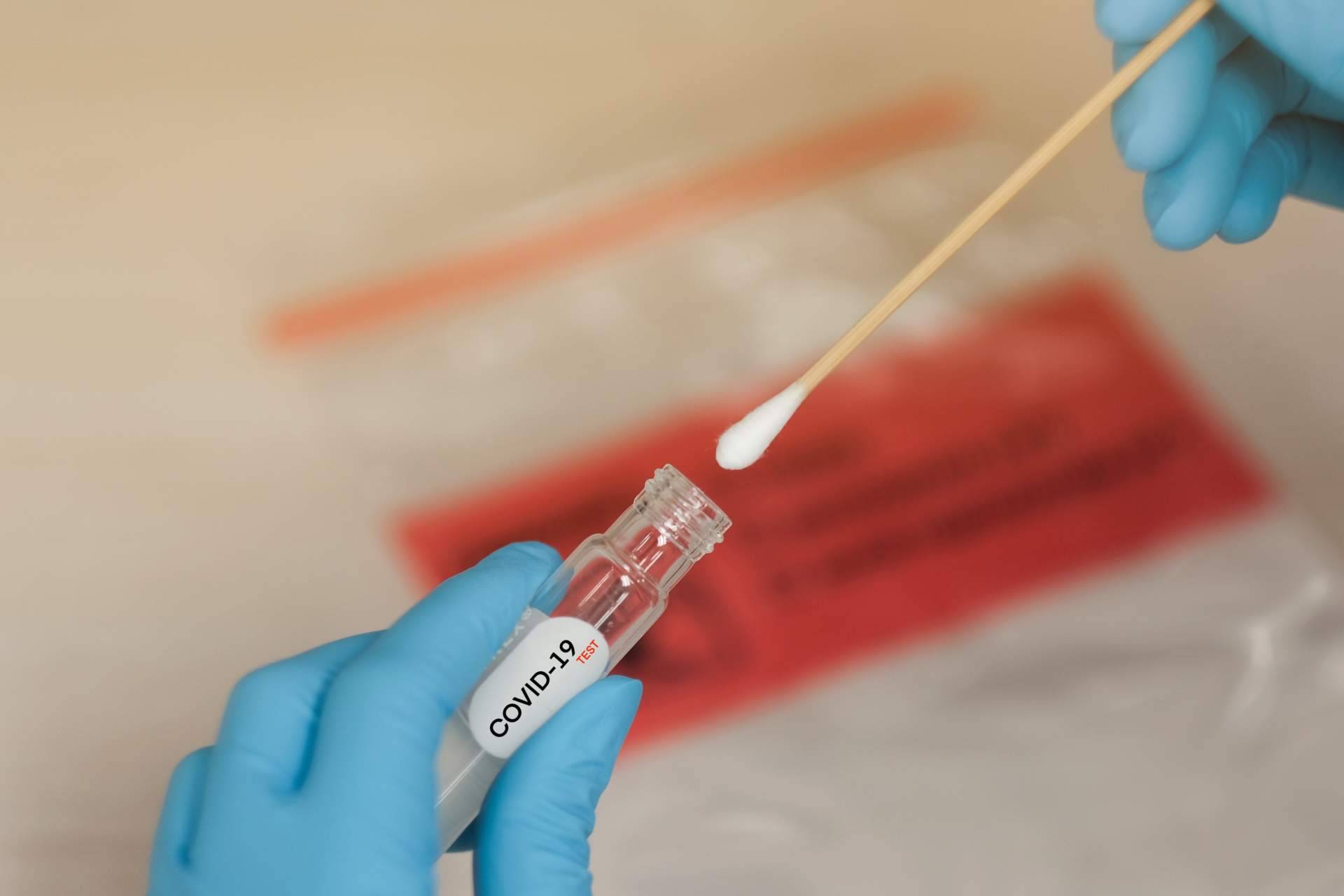 Test covid Madrid para estar tranquilo en las comidas y cenas con familiares, en Centro Médico Bravo