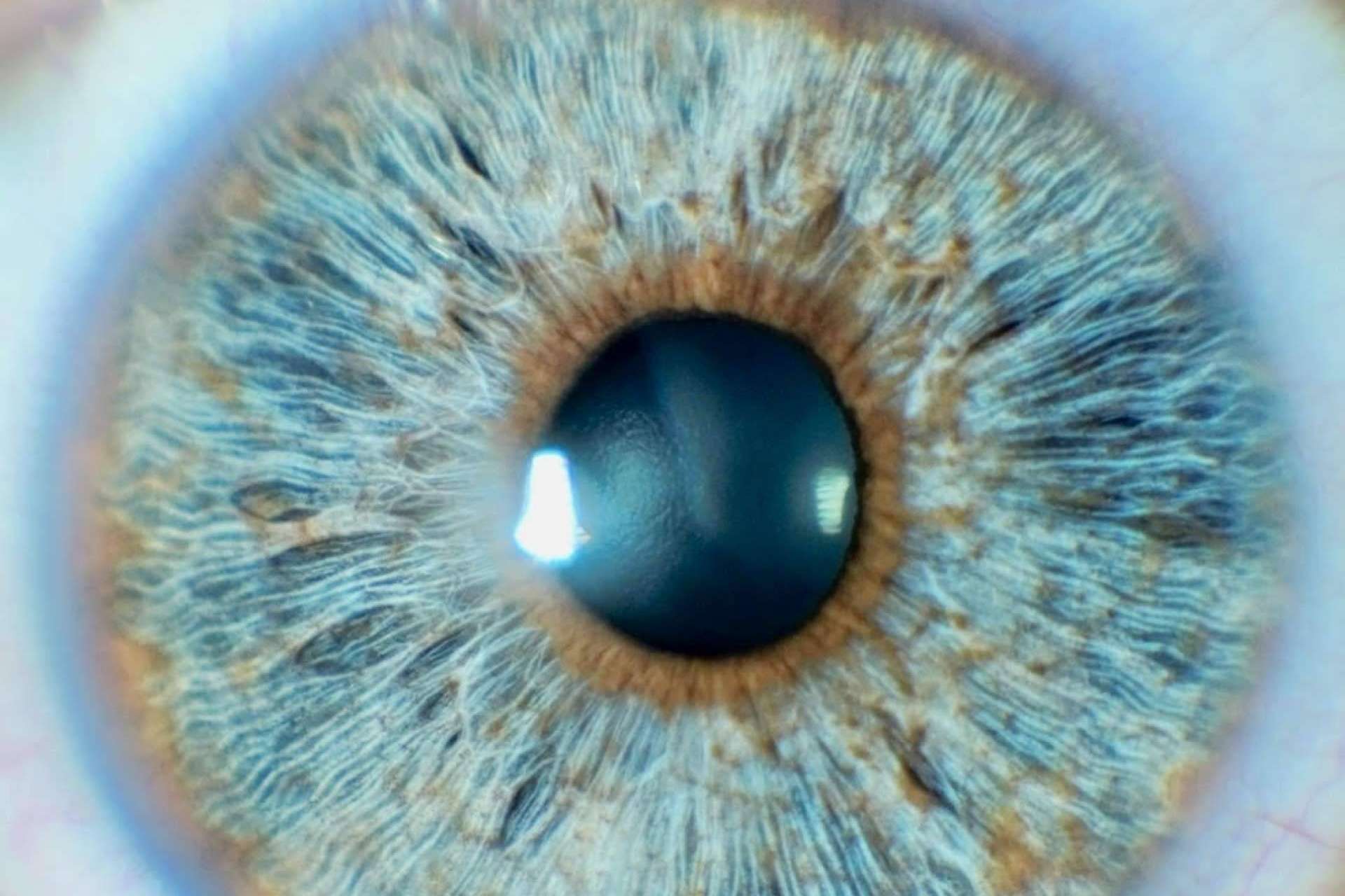 Clínica Eyecos y los avances en las operaciones de cambio de color de ojos con láser