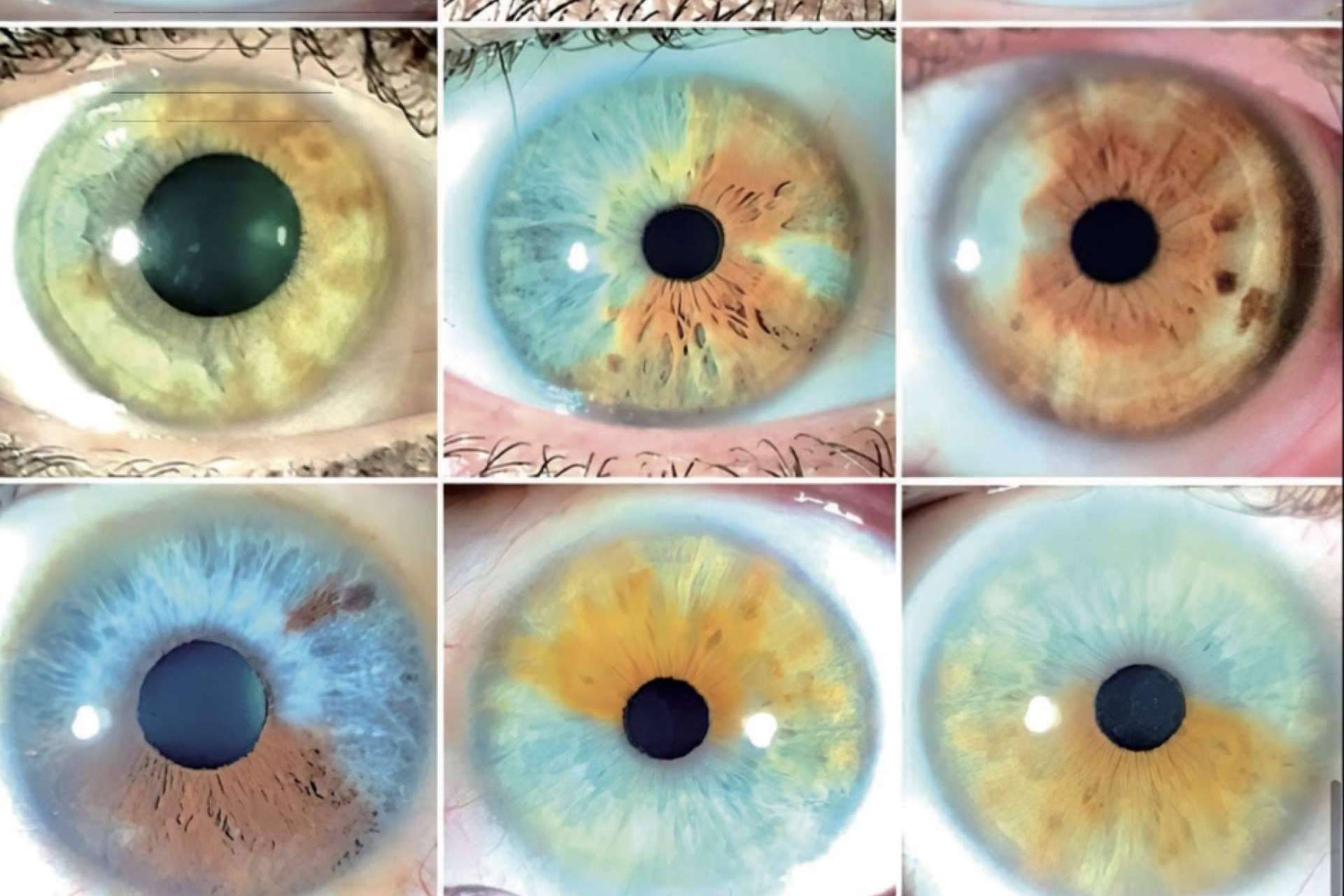 Eyecos presenta el gran libro Atlas sobre el cambio de color de ojos con láser