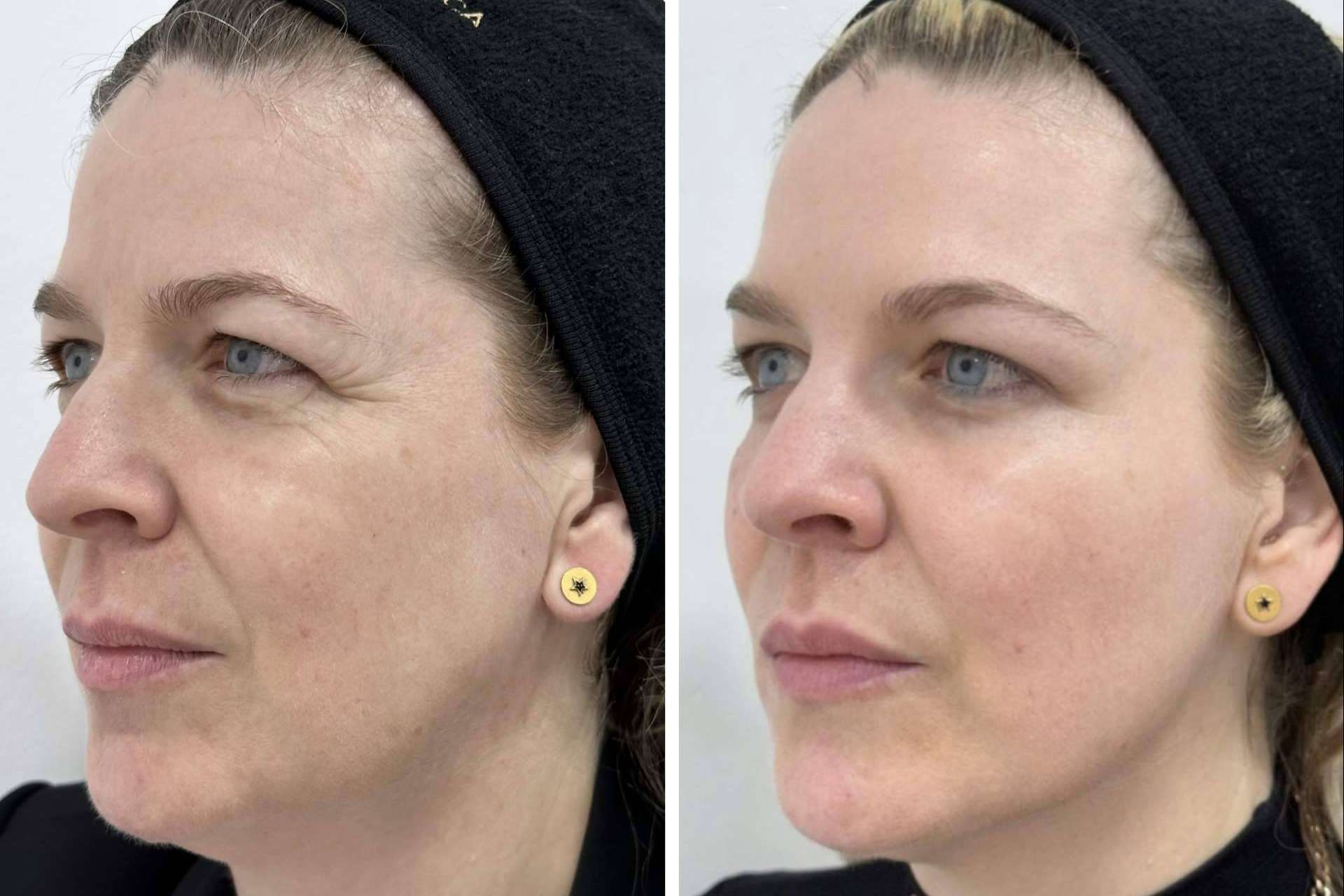 Clínica VISO permite mejorar la apariencia a través de sus tratamientos faciales