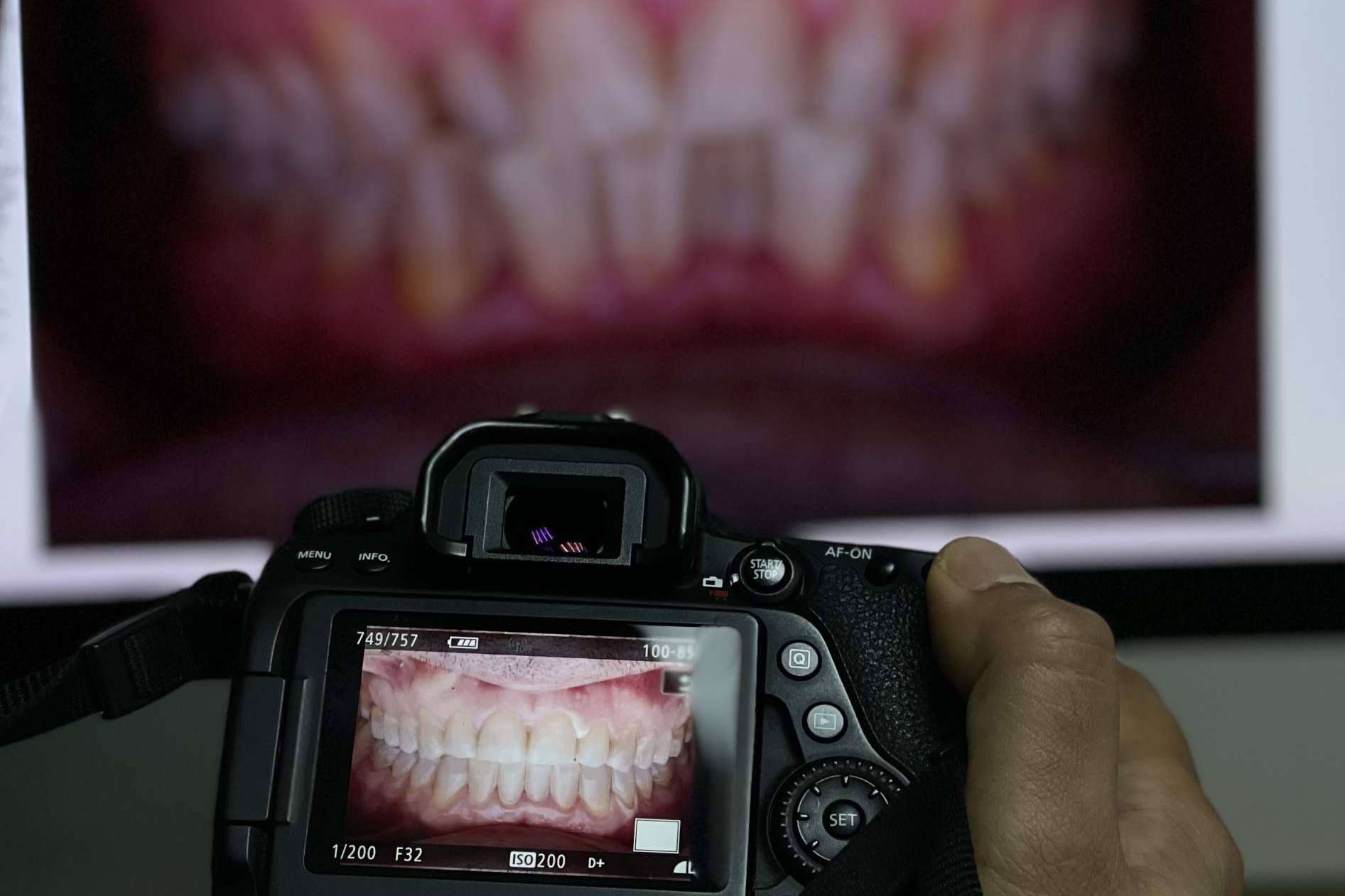 La Clínica Los Llanos Dental en Barcelona ofrece tratamientos de odontología infantil
