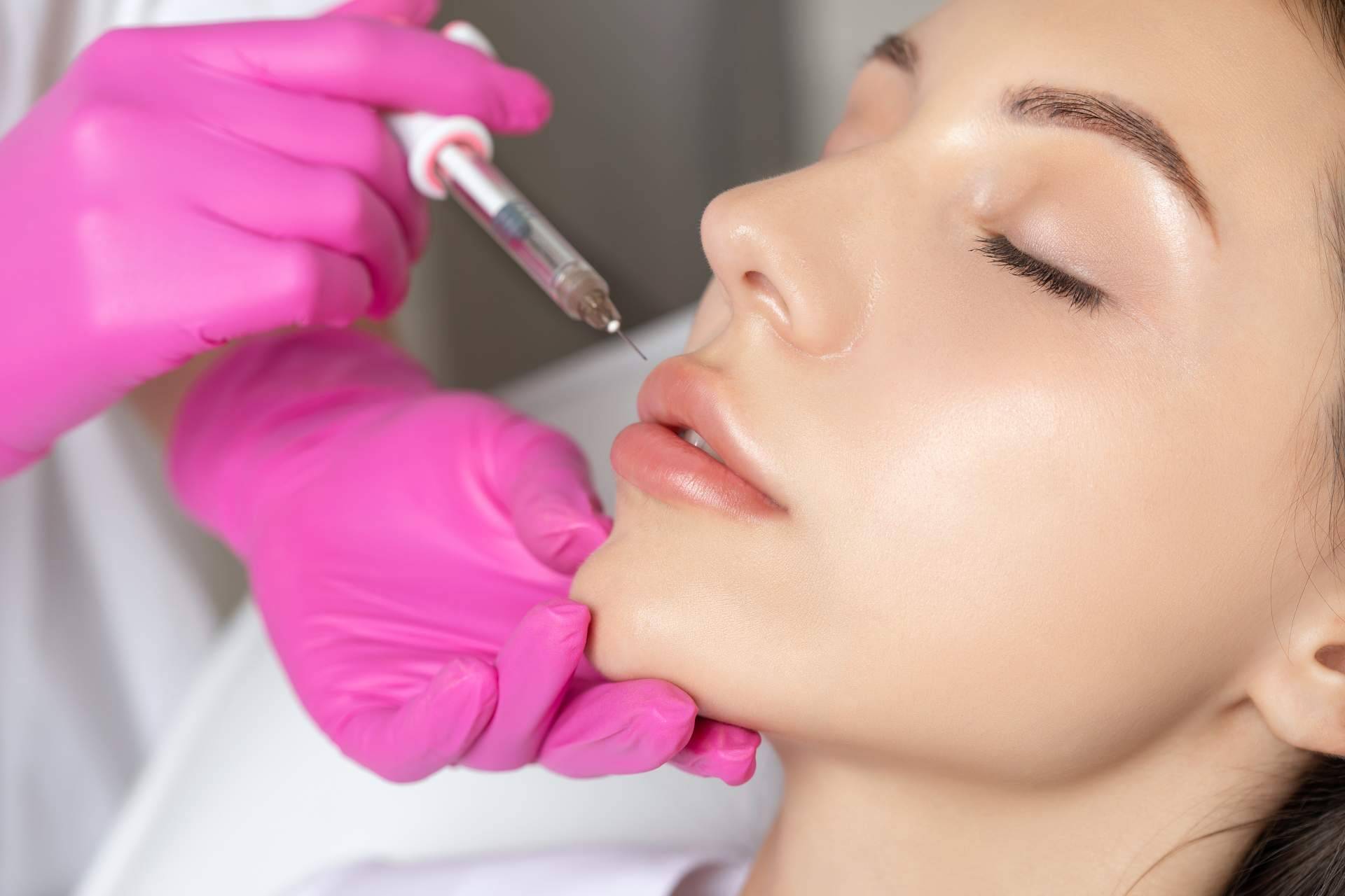 Hidratación de labios con ácido hialurónico en España con el tratamiento de 360Clinics
