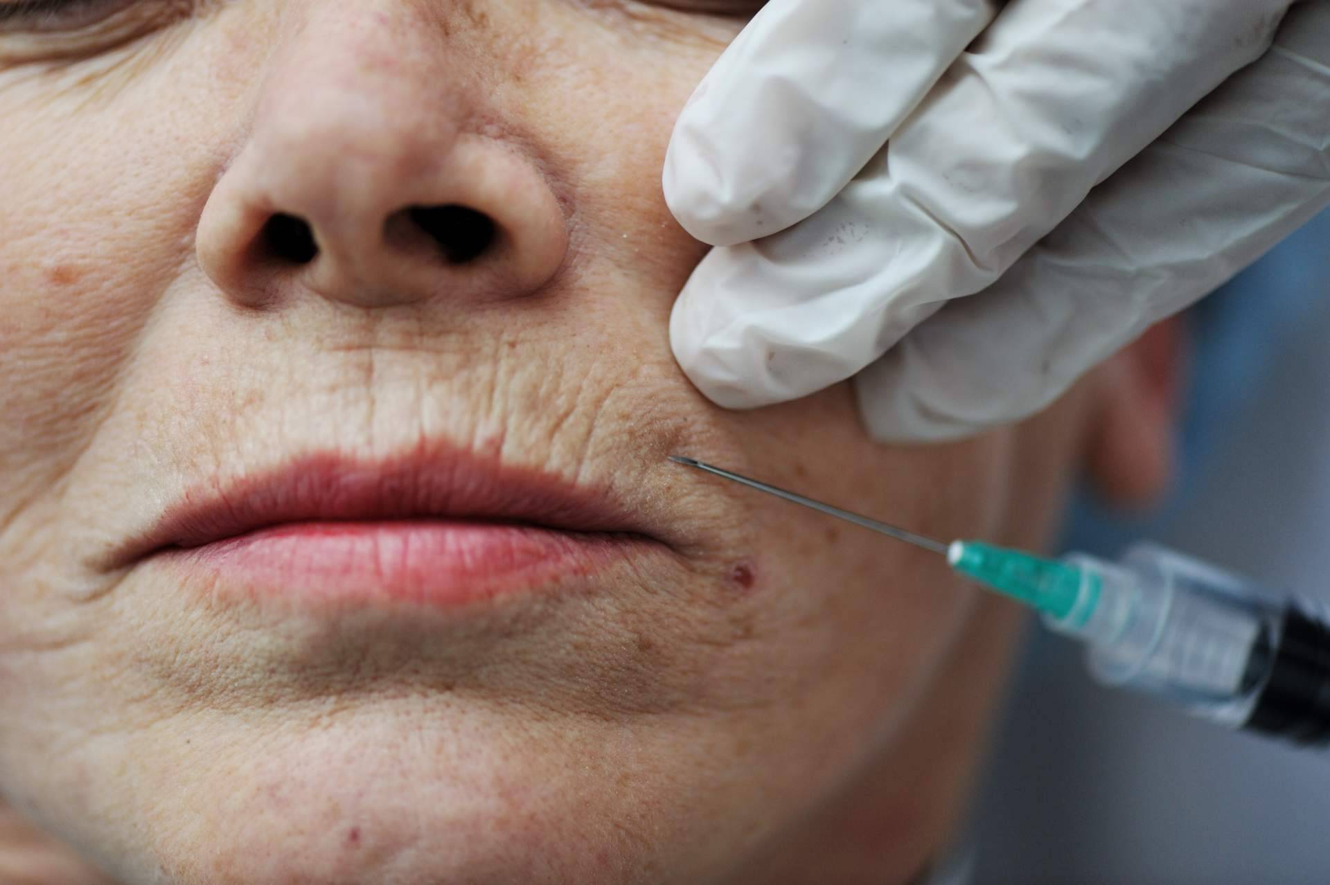 La búsqueda segura del envejecimiento saludable y de los resultados naturales con la medicina estética y well aging