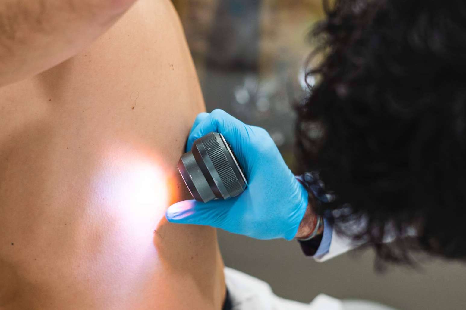 Protegerse ante los melanomas a través de buenos hábitos al sol como medida de protección