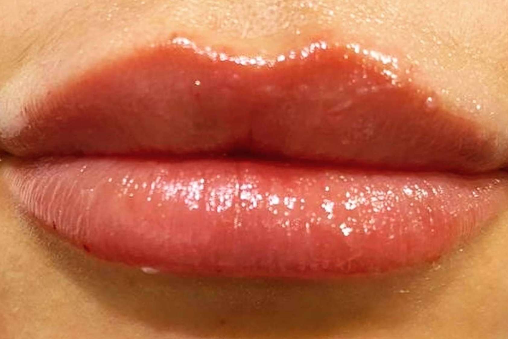 Clínica Amalfi y su tratamiento facial completo para mejorar el aspecto de la piel