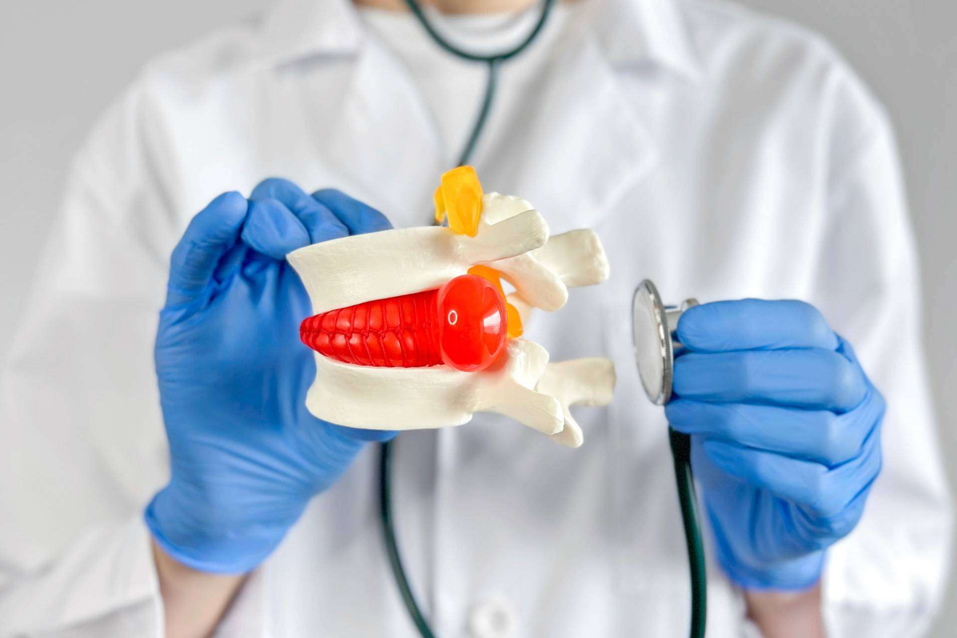 Tratar la hernia discal con andulación, un novedoso enfoque terapéutico