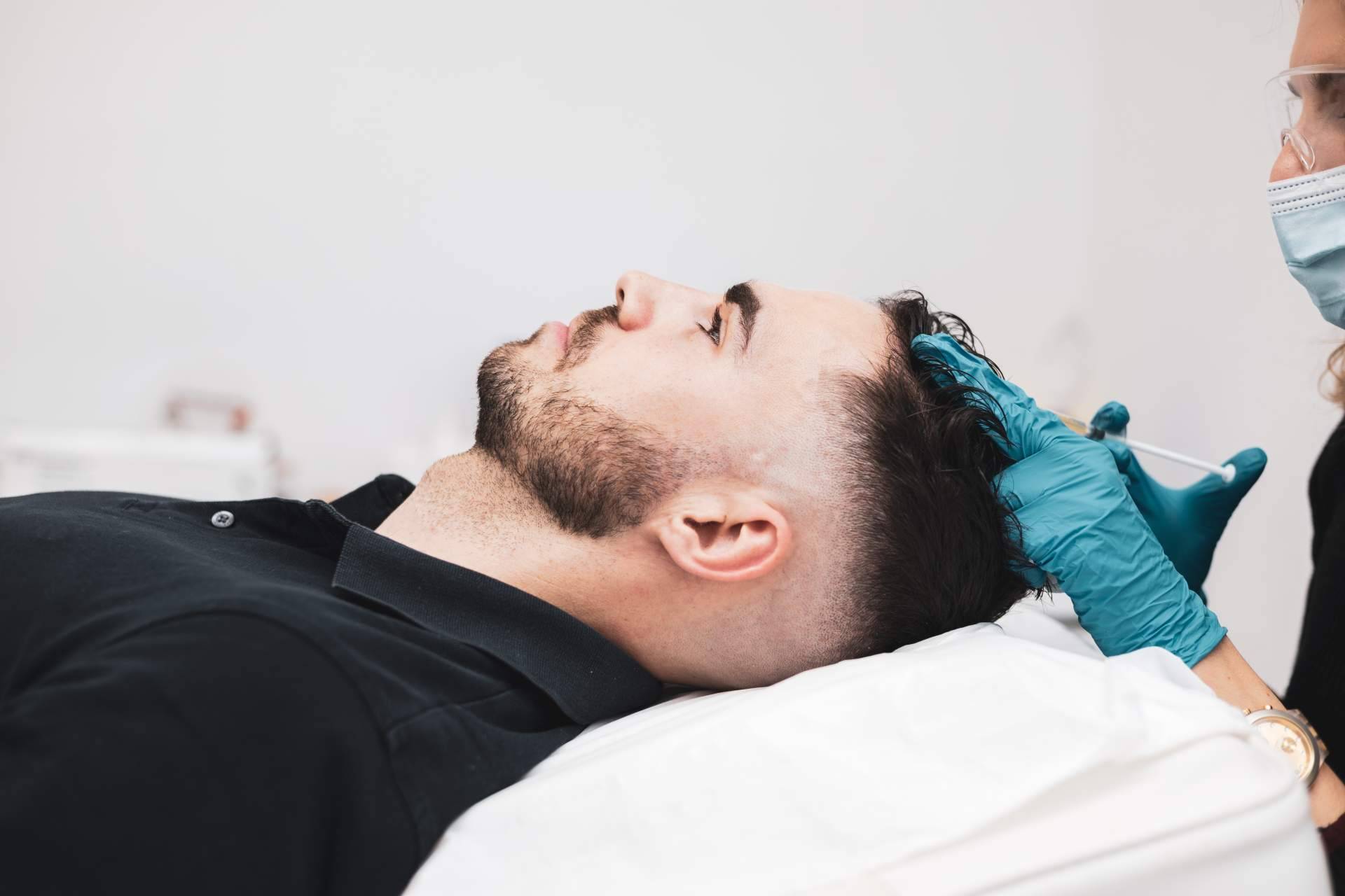 PRP capilar, el tratamiento innovador de Centro Estética El Pilar que estimula el crecimiento del cabello