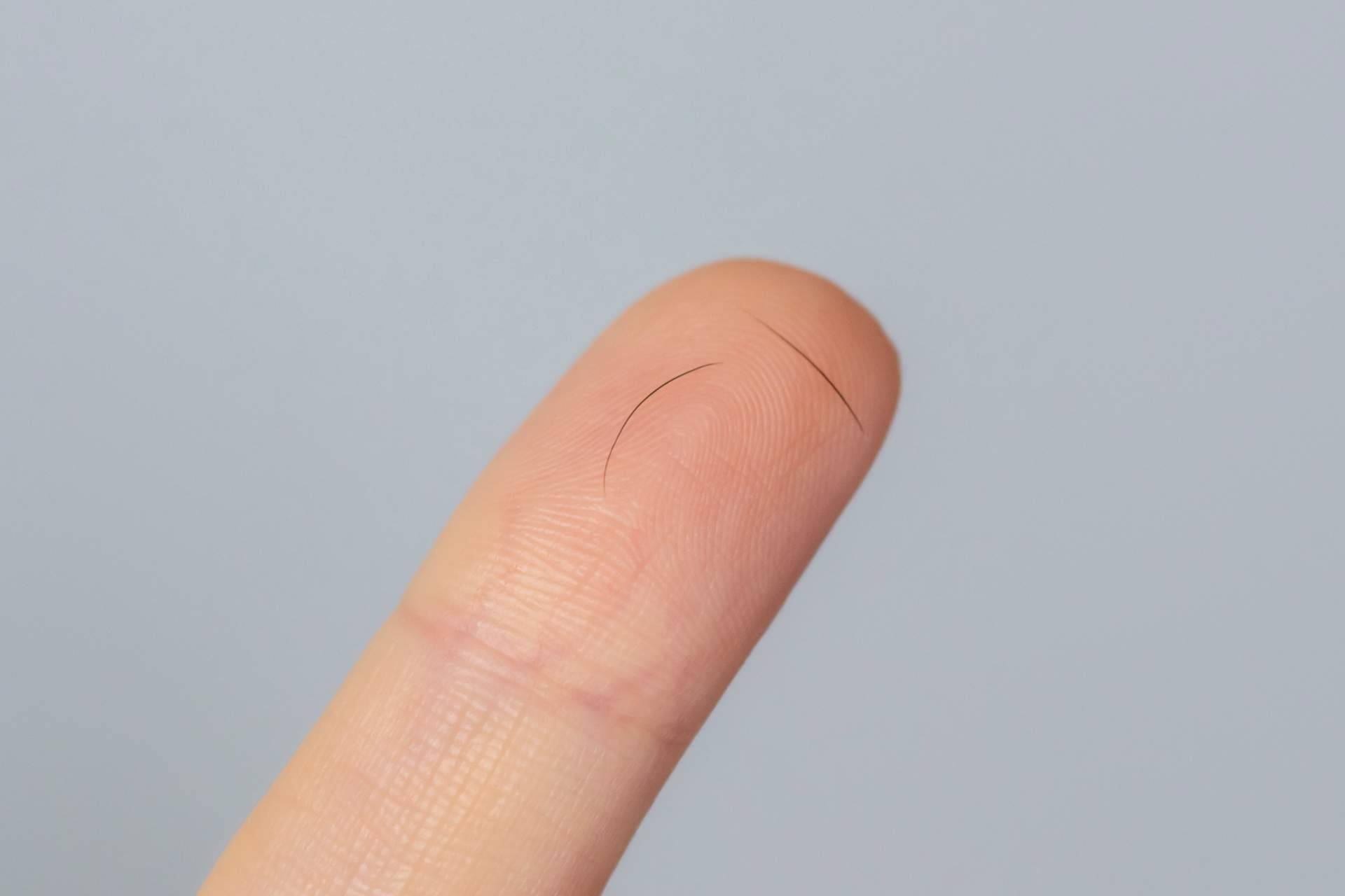 ¿Por qué se cae el pelo de las cejas? El Doctor Jesús Mora y Capilar Innovation Clinic lo explican