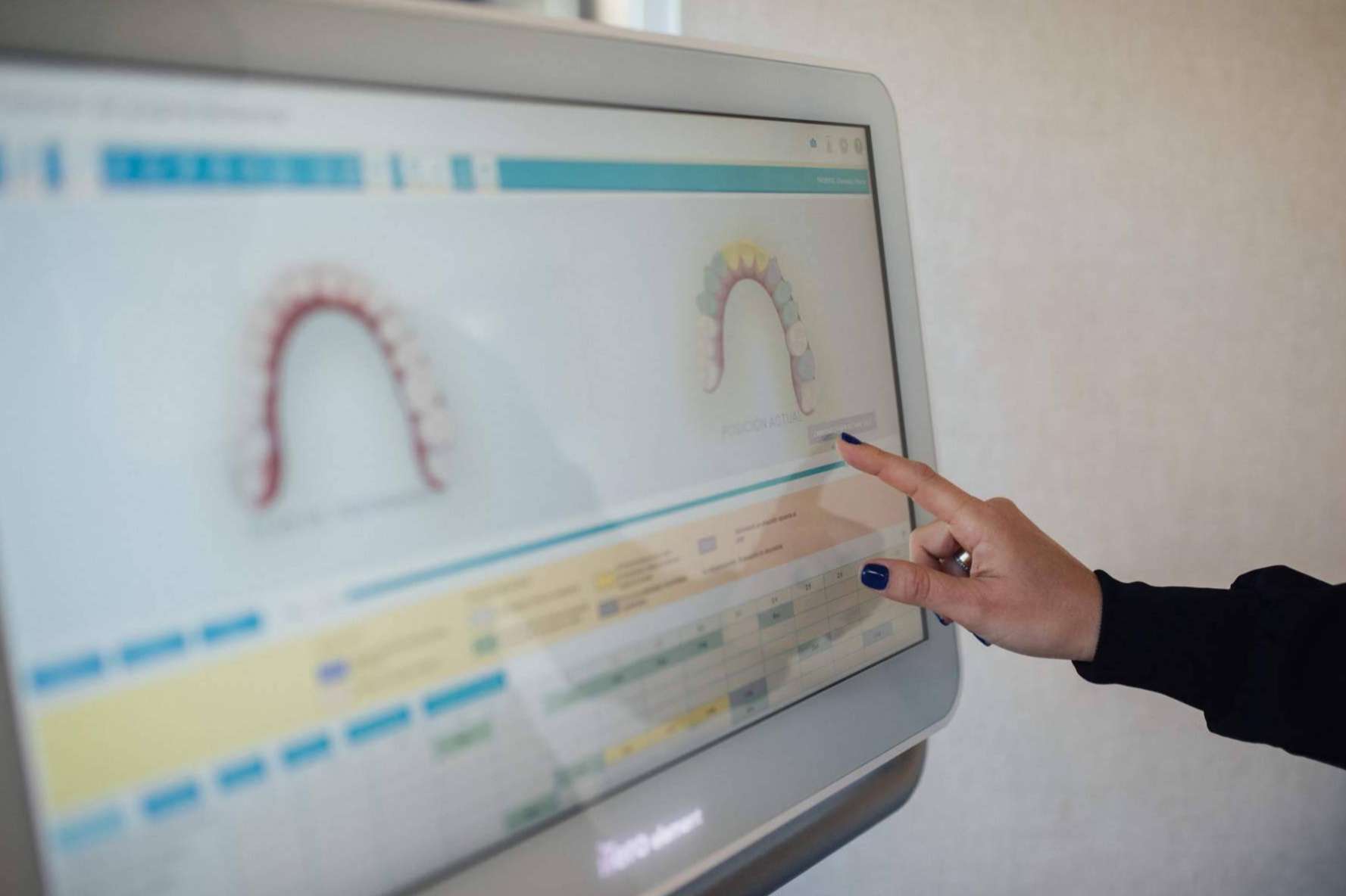 Clínica Dental Claris, expertos en el tratamiento de patologías dentales crónicas