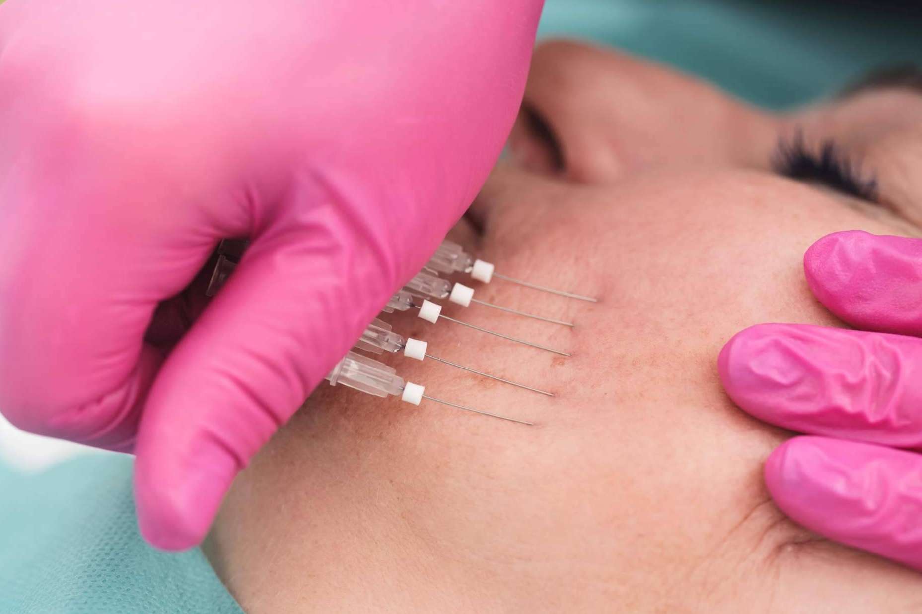 Dermasthetic presenta sus cursos de especialización para médicos que se dedican a la estética