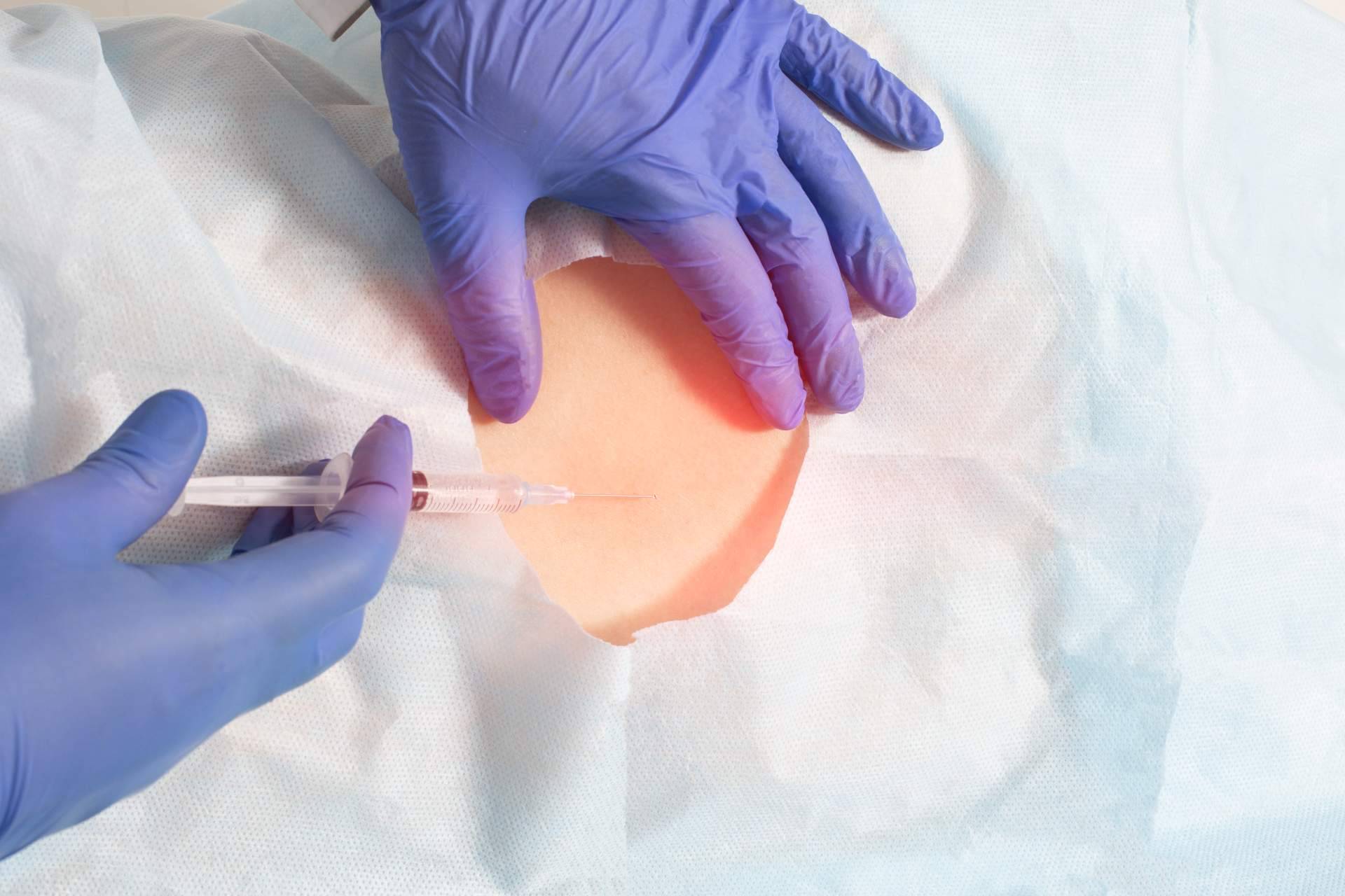 La Unidad de Columna y Traumatología de Biziondo sobre el tratamiento de ozonoterapia