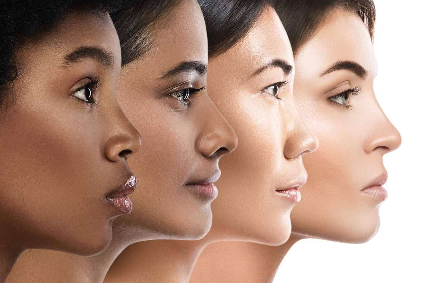 Tres técnicas para el tratamiento en labios con ácido hialurónico; aumento de labios, hidratación y perfilado o Extreme Lips