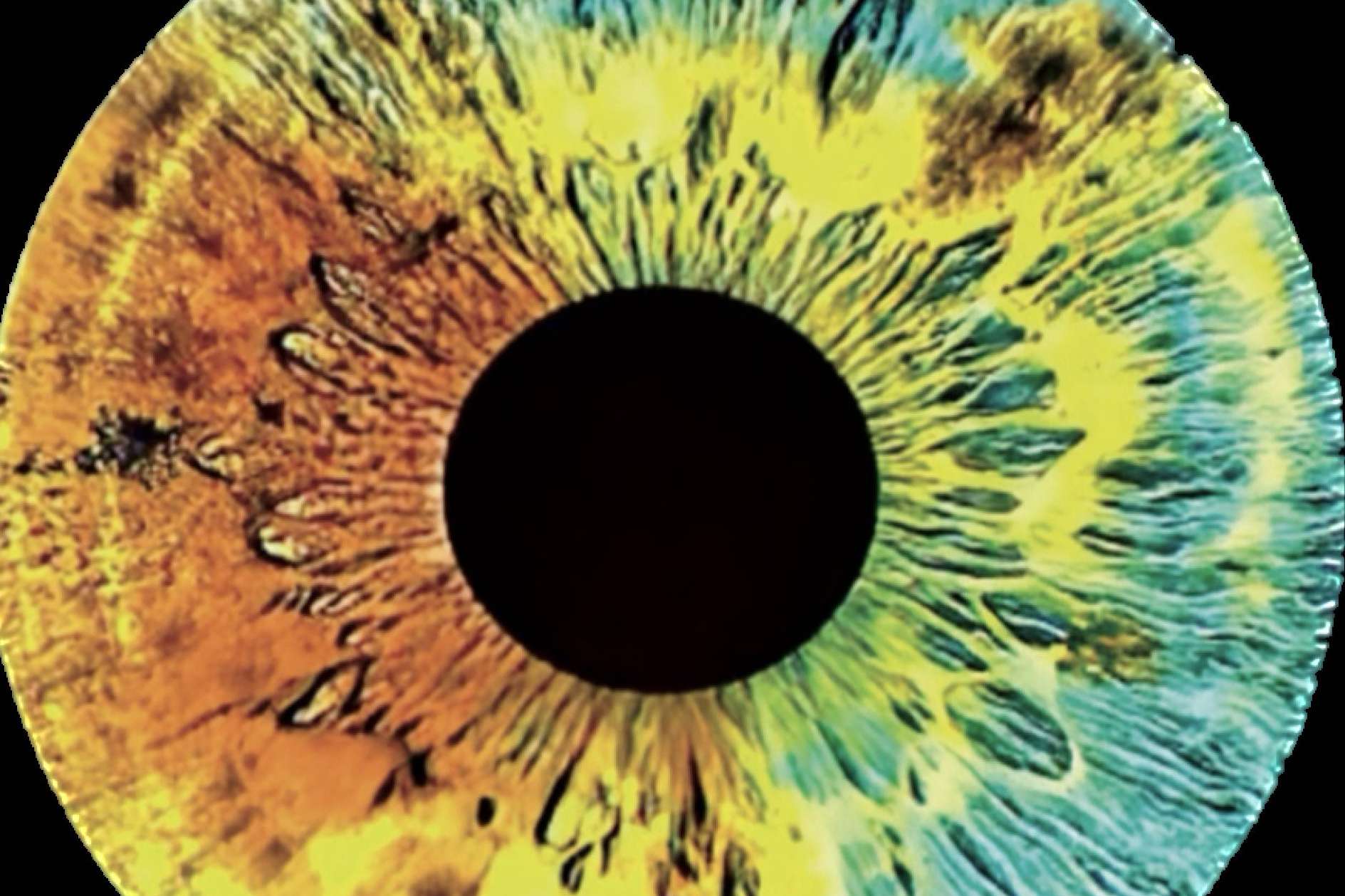 Clínica Eyecos investiga los genes del color de ojos
