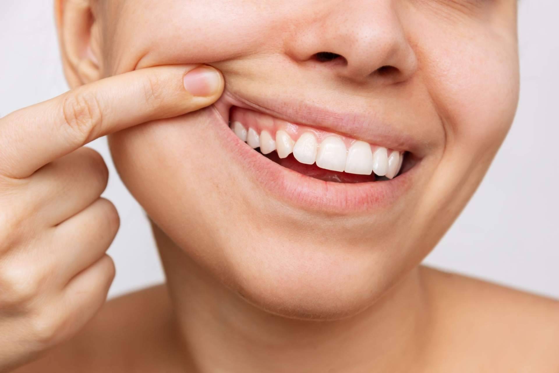 Farmasky y las claves para tener salud bucodental
