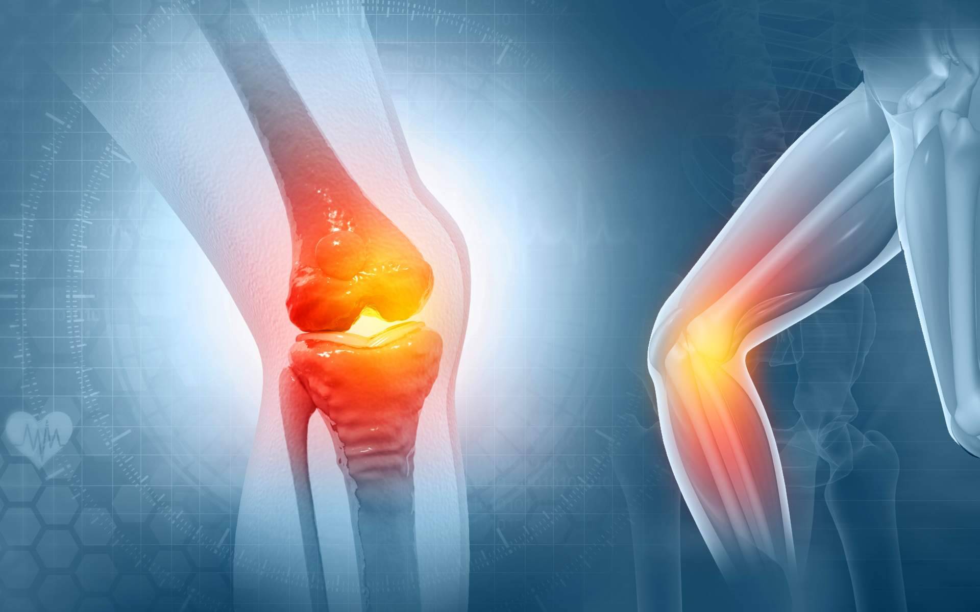 iXalud estará presente en el 7º Congreso Internacional de Pacientes con Artrosis