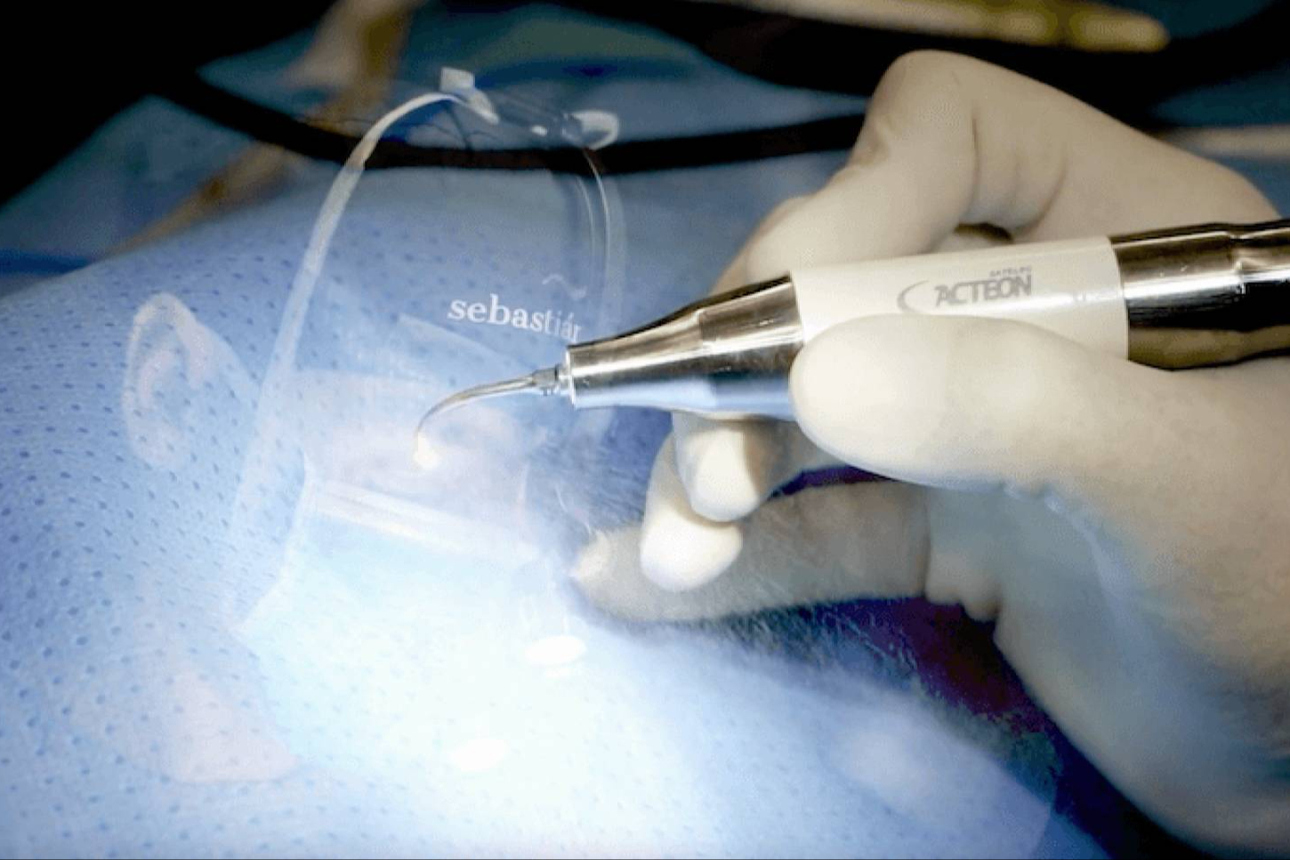 La innovación tecnológica transforma la rinoplastia en una cirugía de alta precisión