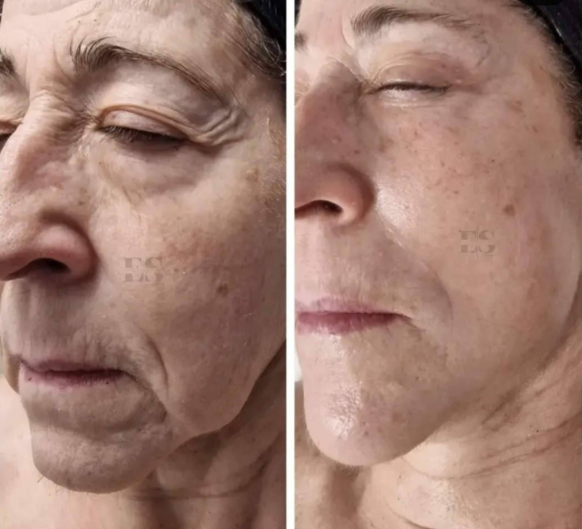 Belleza y tratamientos avanzados, la propuesta especializada de Estética Elena Santos